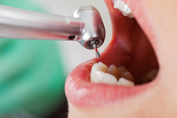 Dentist for Dental Trauma in ID